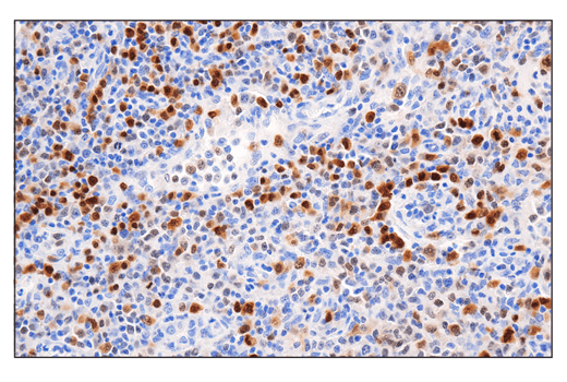 Immunohistochemistry Image 2: IRF-4 (E8H3S) XP<sup>®</sup> Rabbit mAb