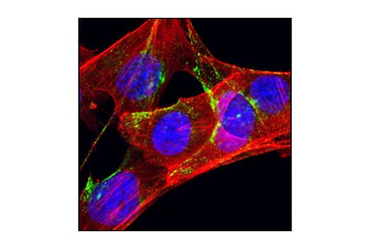 Immunofluorescence Image 1: Caveolin-1 (D46G3) Rabbit Monoclonal Antibody