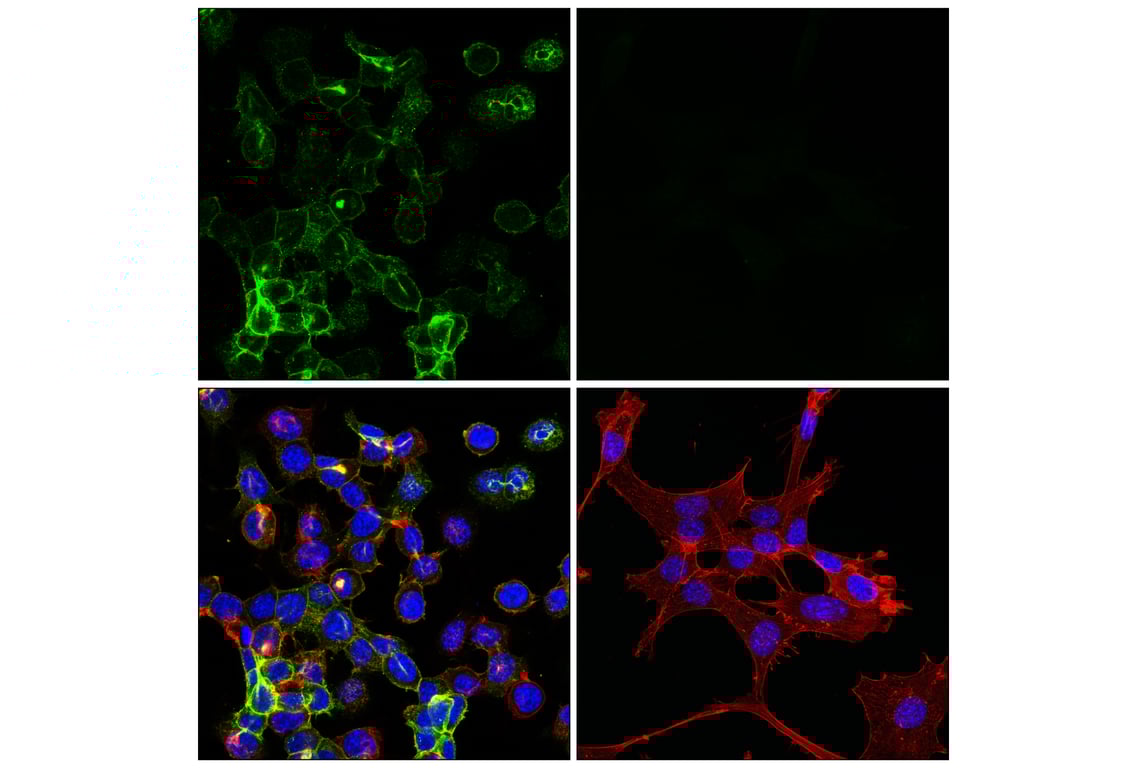 Immunofluorescence Image 1: GAP43 (E1U1D) Mouse Monoclonal Antibody