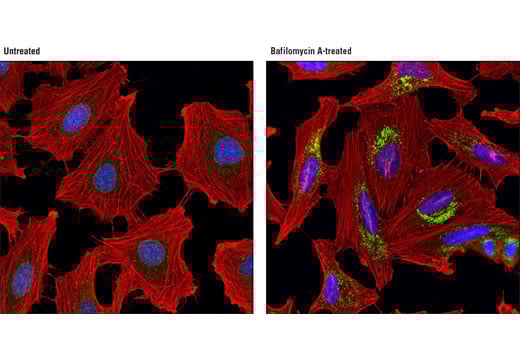undefined Image 2: Bafilomycin A1