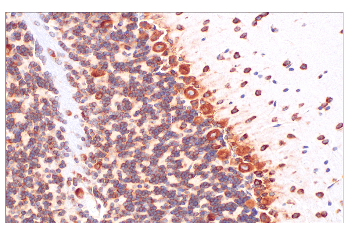 Immunohistochemistry Image 6: PABP1 (F6G6L) Rabbit Monoclonal Antibody