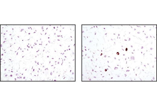 Immunohistochemistry Image 1: Perilipin-1 (D418) Antibody