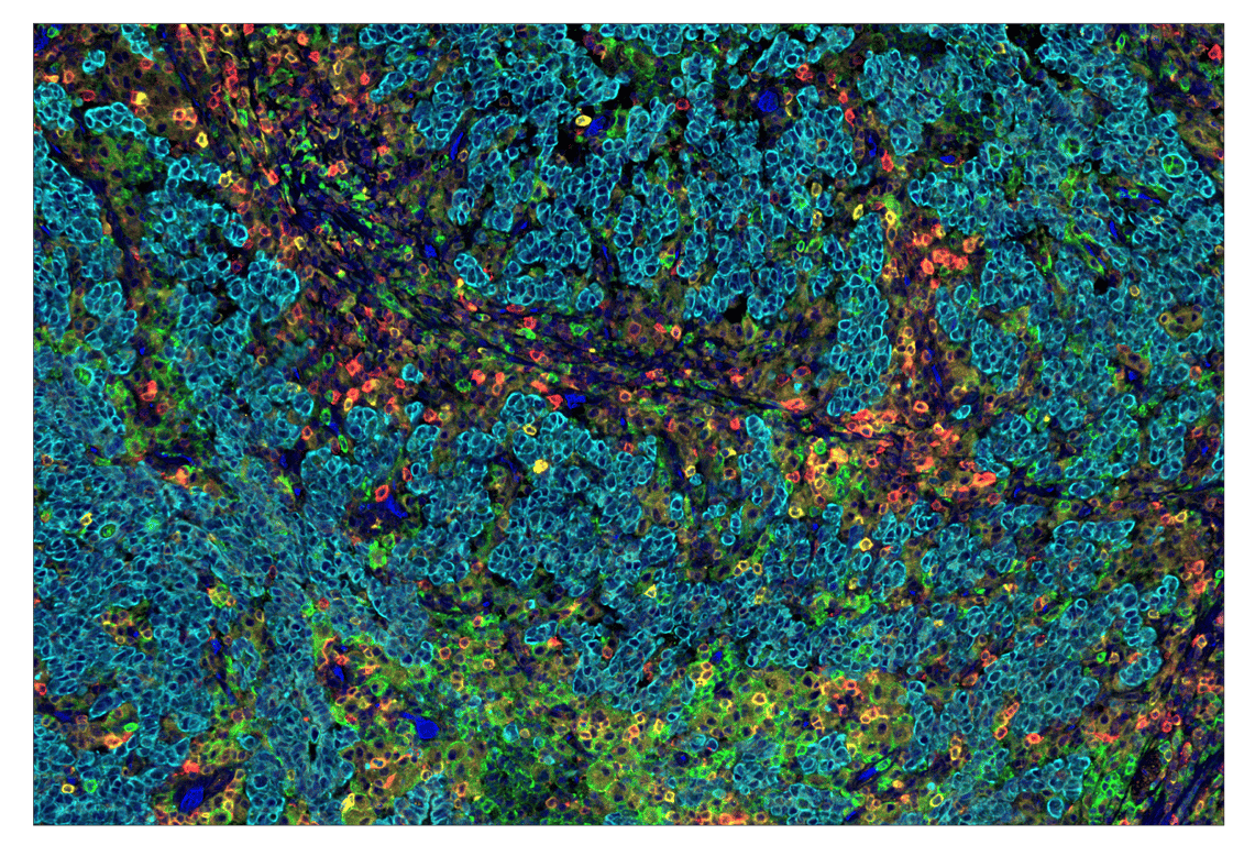 Immunohistochemistry Image 1: Phospho-SLP-76 (Ser376) (E3G9U) & CO-0018-488 SignalStar<sup>™</sup> Oligo-Antibody Pair