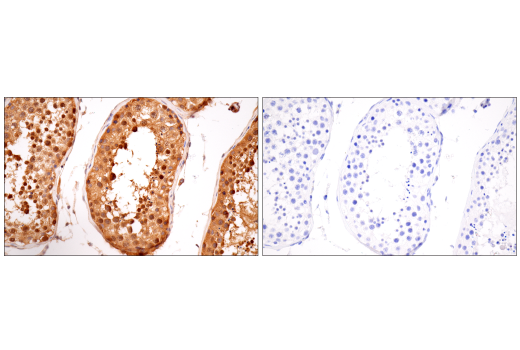 Immunohistochemistry Image 11: B-Raf (E3T5C) Mouse Monoclonal Antibody (BSA and Azide Free)