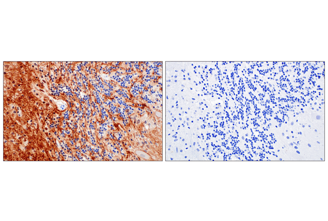 Immunohistochemistry Image 4: OMG (F8B7X) Rabbit Monoclonal Antibody