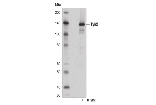 Western Blotting Image 2: Tyk2 (D4I5T) Rabbit Monoclonal Antibody