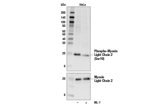 Western Blotting Image 2: Phospho-Myosin Light Chain 2 (Ser19) Mouse Monoclonal Antibody