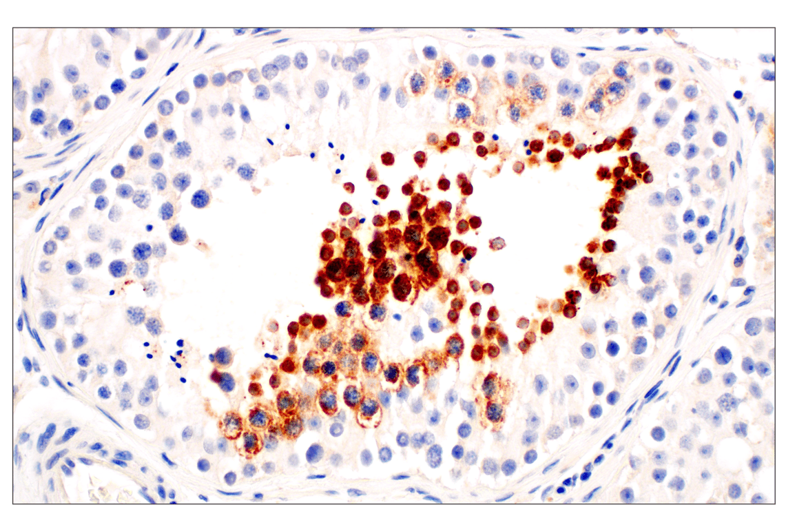 Immunohistochemistry Image 5: IL-13RA2/CD213a2 (E7U7B) Rabbit Monoclonal Antibody (BSA and Azide Free)