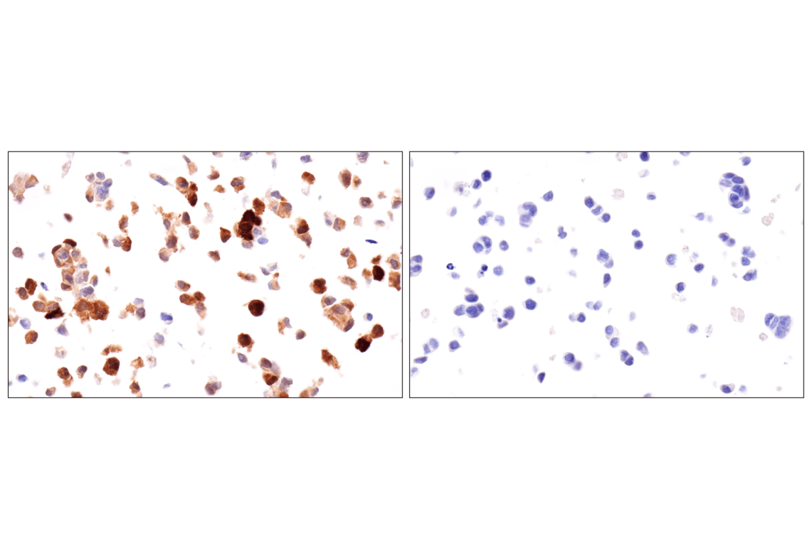 Immunohistochemistry Image 17: Transgelin/TAGLN (F3B7H) Rabbit Monoclonal Antibody