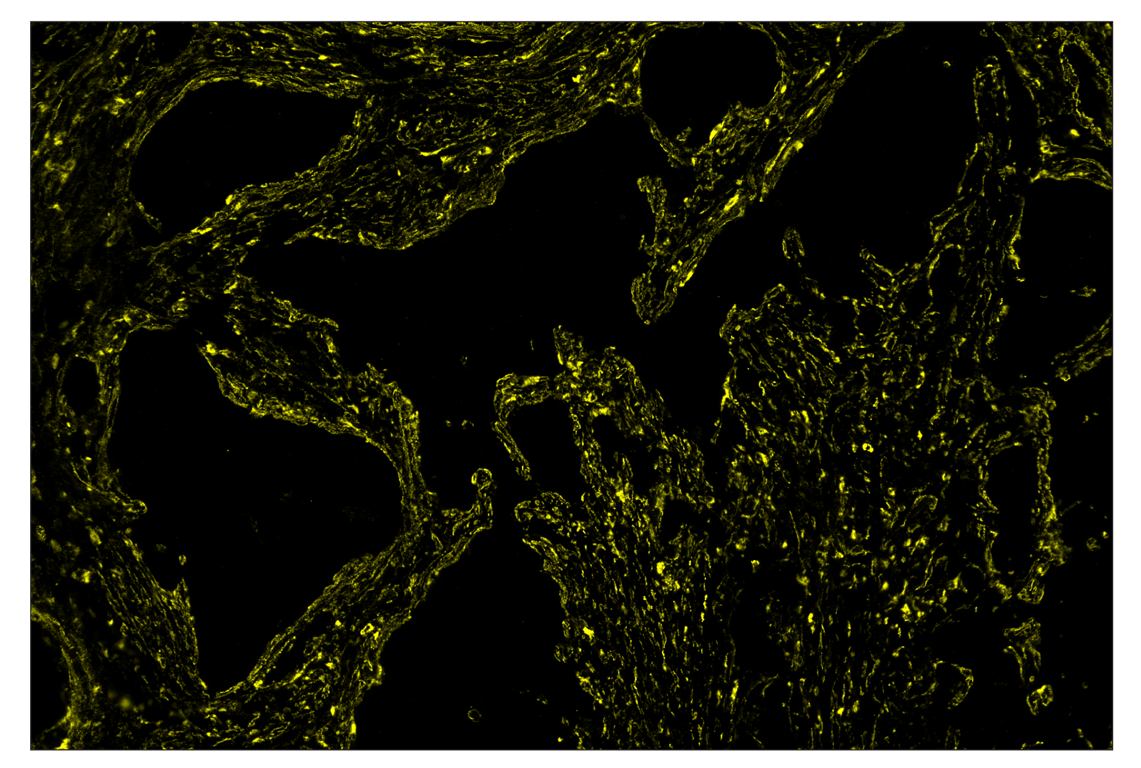 Immunohistochemistry Image 4: alpha-Smooth Muscle Actin (D4K9N) & CO-0024-488 SignalStar<sup>™</sup> Oligo-Antibody Pair