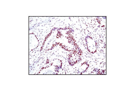 Immunohistochemistry Image 2: Ku80 (C48E7) Rabbit Monoclonal Antibody (BSA and Azide Free)