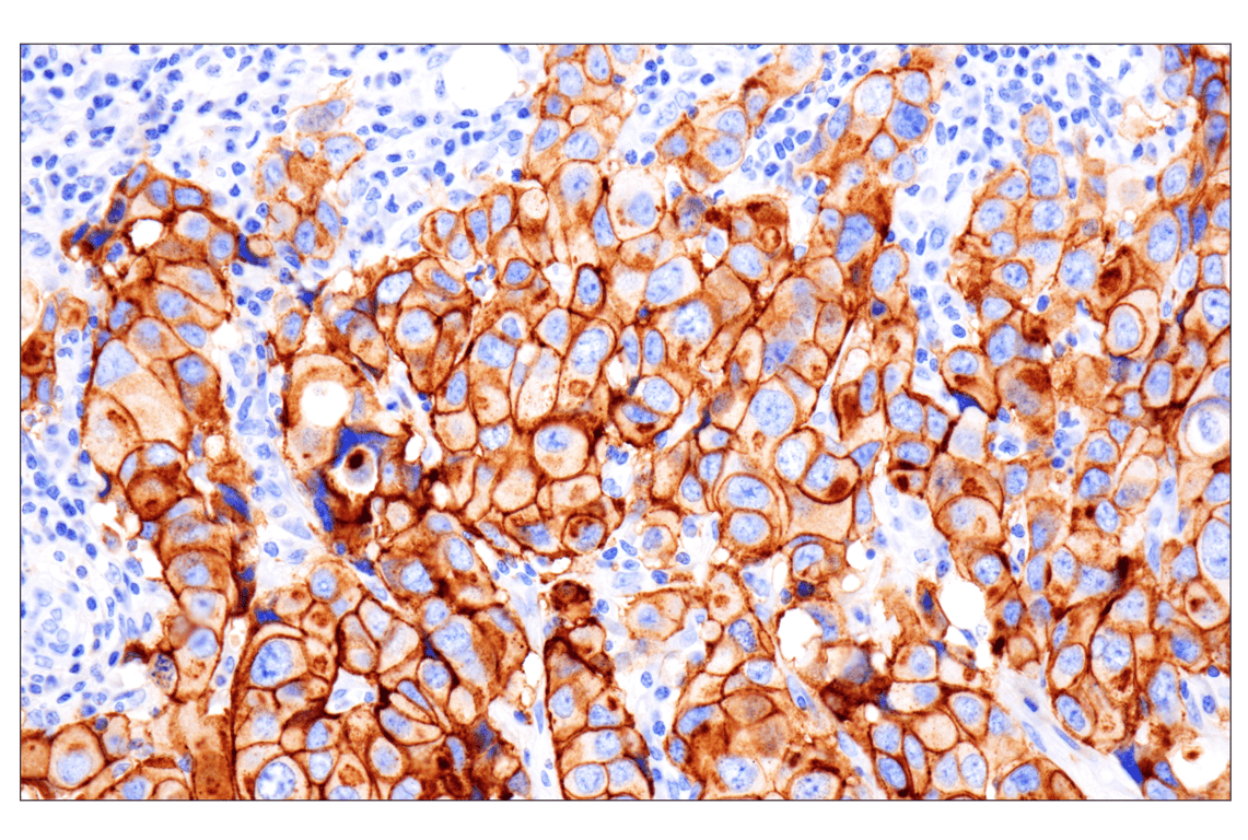 Immunohistochemistry Image 2: FGF Receptor 2 (D4L2V) Rabbit Monoclonal Antibody