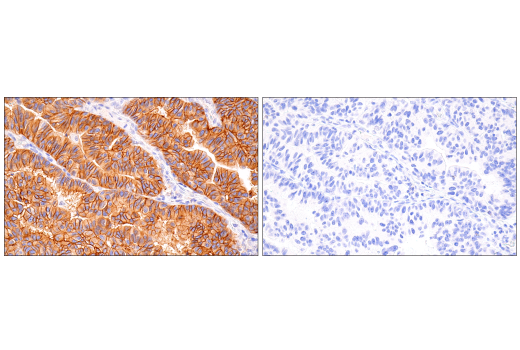 Immunohistochemistry Image 2: HER2/ErbB2 (CB11) Mouse Monoclonal Antibody