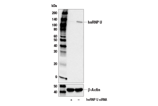 Western Blotting Image 1: hnRNP U (E2O1R) Rabbit mAb