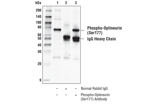 Immunoprecipitation Image 1: Phospho-Optineurin (Ser177) Antibody