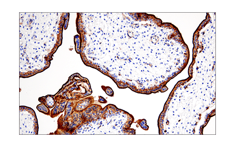 Immunohistochemistry Image 3: CD200 (E5I9V) Rabbit Monoclonal Antibody