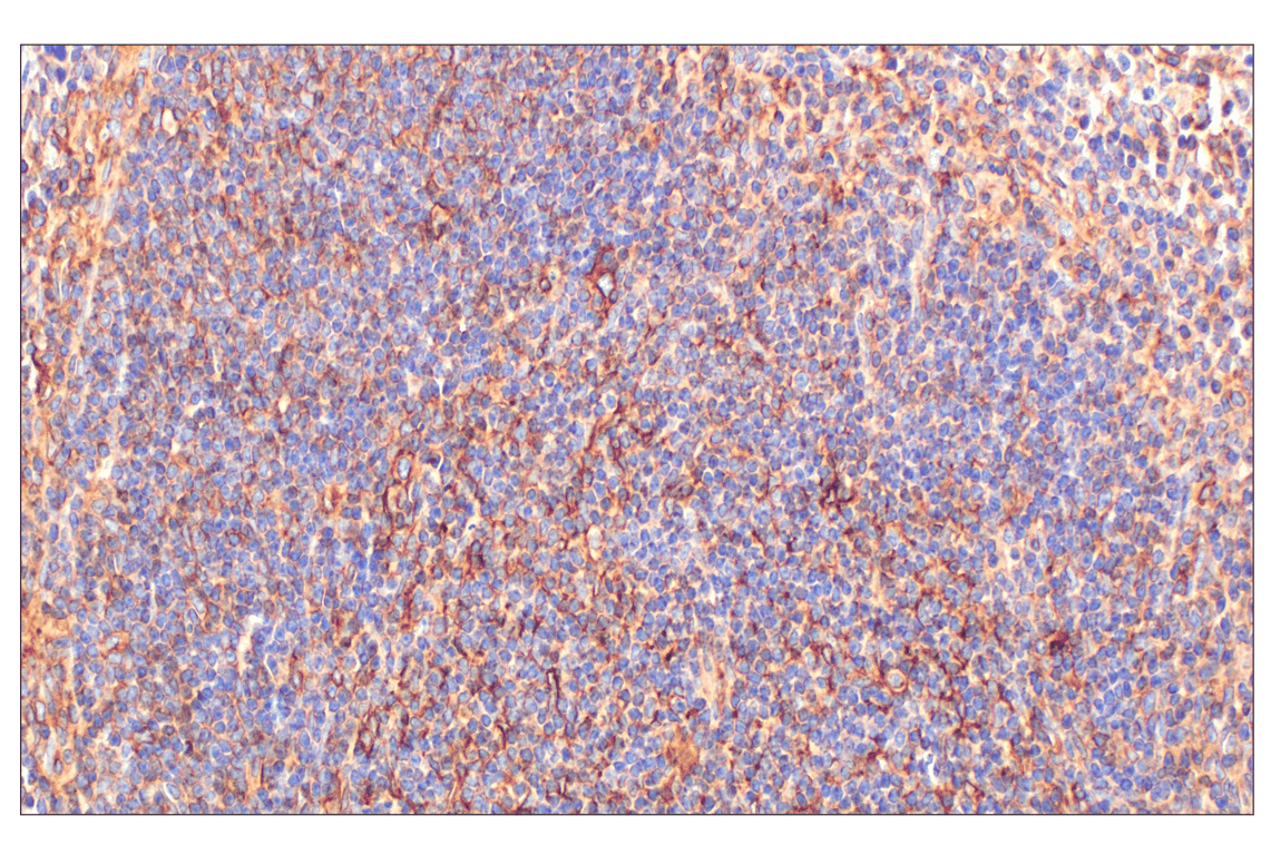 Immunohistochemistry Image 4: beta2-microglobulin (F4S6H) Rabbit Monoclonal Antibody