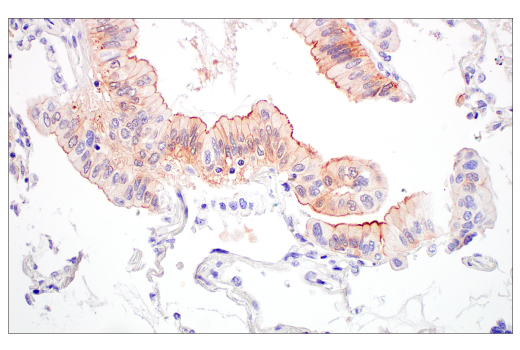Immunohistochemistry Image 4: Villin-1 (CWWB1) Mouse Monoclonal Antibody