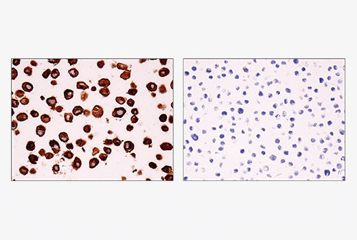 Immunohistochemistry Image 4: IL-13RA2/CD213a2 (E7U7B) Rabbit Monoclonal Antibody (BSA and Azide Free)