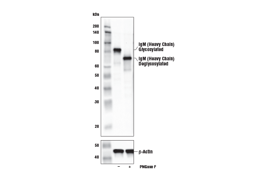 Western Blotting Image 2: IgM Antibody