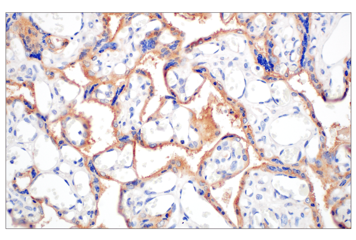 Immunohistochemistry Image 5: Folate Receptor Alpha/FOLR1 (E8U2F) Mouse Monoclonal Antibody