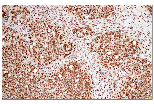 Immunohistochemistry Image 5: RPA32/RPA2 (E8X5P) XP<sup>®</sup> Rabbit mAb