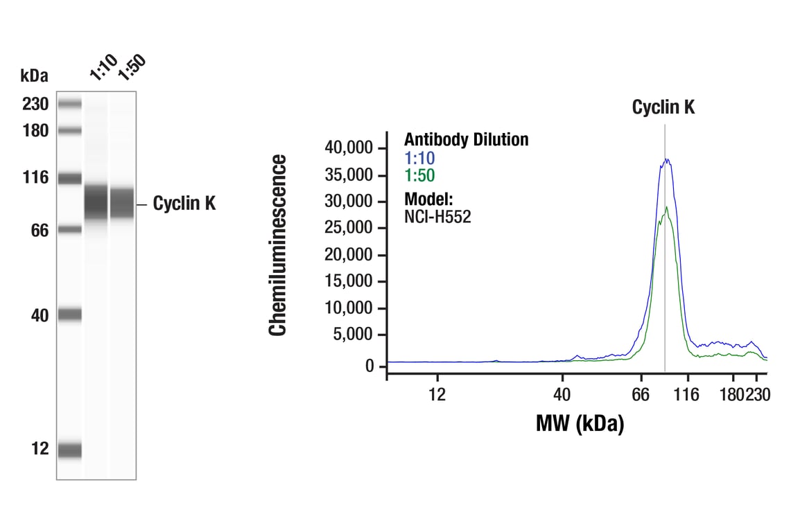 Western Blotting Image 1: Cyclin K (F1F2I) Rabbit Monoclonal Antibody