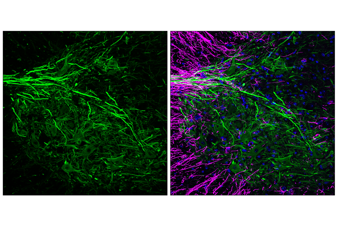 Immunofluorescence Image 2: Peripherin (F3J1R) Rabbit Monoclonal Antibody