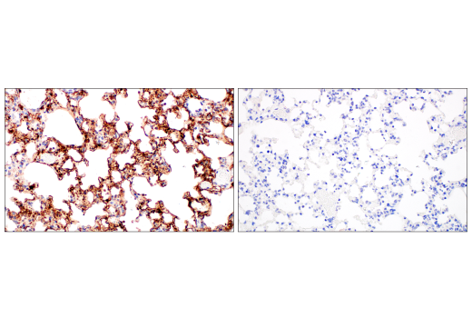Immunohistochemistry Image 2: SARS-CoV-2 Nucleocapsid Protein (E9L7H) Rabbit Monoclonal Antibody