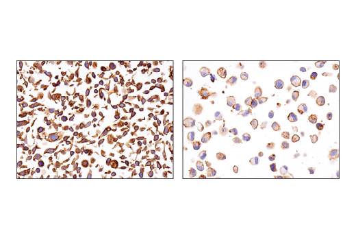 Immunohistochemistry Image 1: ASCT2 (D7C12) Rabbit Monoclonal Antibody