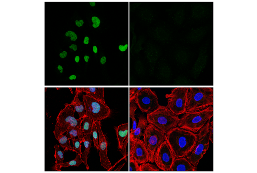 Immunofluorescence Image 1: SIX2 (E7C3J) Rabbit Monoclonal Antibody