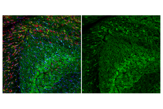 Immunofluorescence Image 3: Neurogranin (E9L8D) Rabbit Monoclonal Antibody