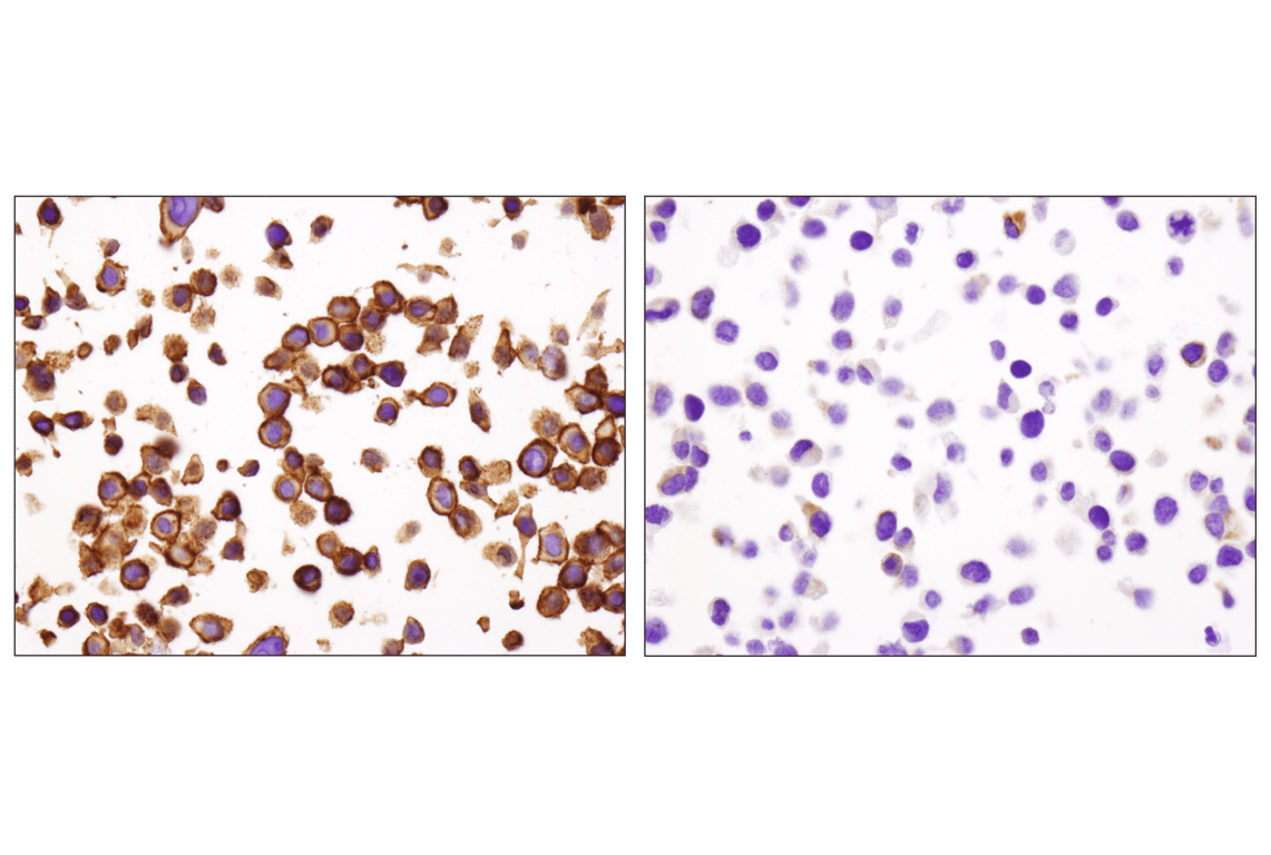 Immunohistochemistry Image 9: EpCAM (D9S3P) Rabbit Monoclonal Antibody