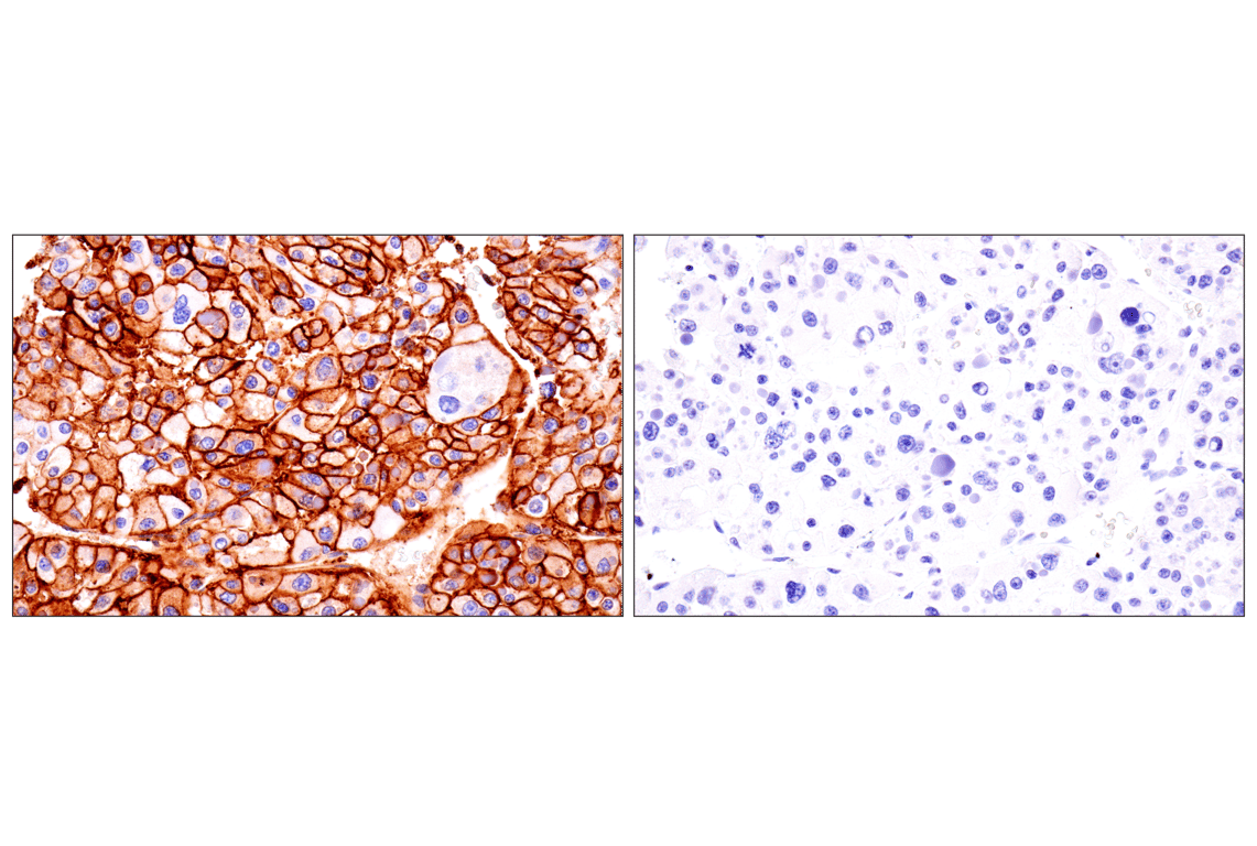 Immunohistochemistry Image 10: HLA-B (BC43) Mouse Monoclonal Antibody