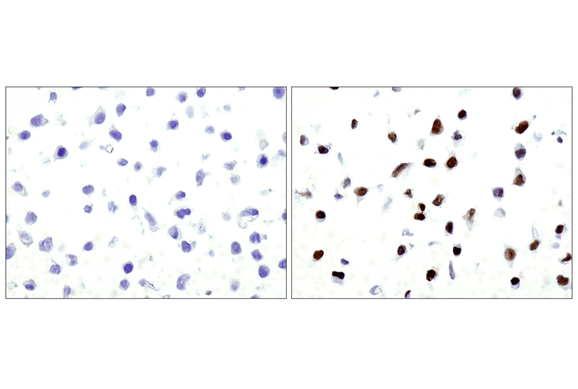 Immunohistochemistry Image 2: Phospho-Stat3 (Tyr705) (M9C6) Mouse Monoclonal Antibody