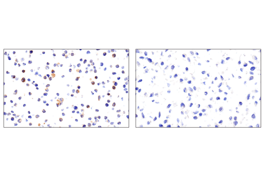 Immunohistochemistry Image 4: 4-1BBL/CD137L/TNFSF9 (E8W3P) Rabbit Monoclonal Antibody