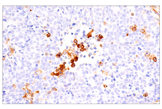 Immunohistochemistry Image 3: FcRn (E9J8W) Rabbit Monoclonal Antibody (BSA and Azide Free)