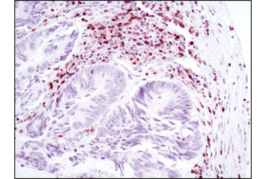 Immunohistochemistry Image 2: NFAT1 (D43B1) Rabbit Monoclonal Antibody (BSA and Azide Free)