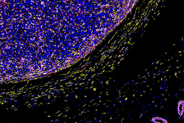 SignalStar multiplex immunohistochemical analysis of paraffin-embedded GL261 syngeneic tumor.