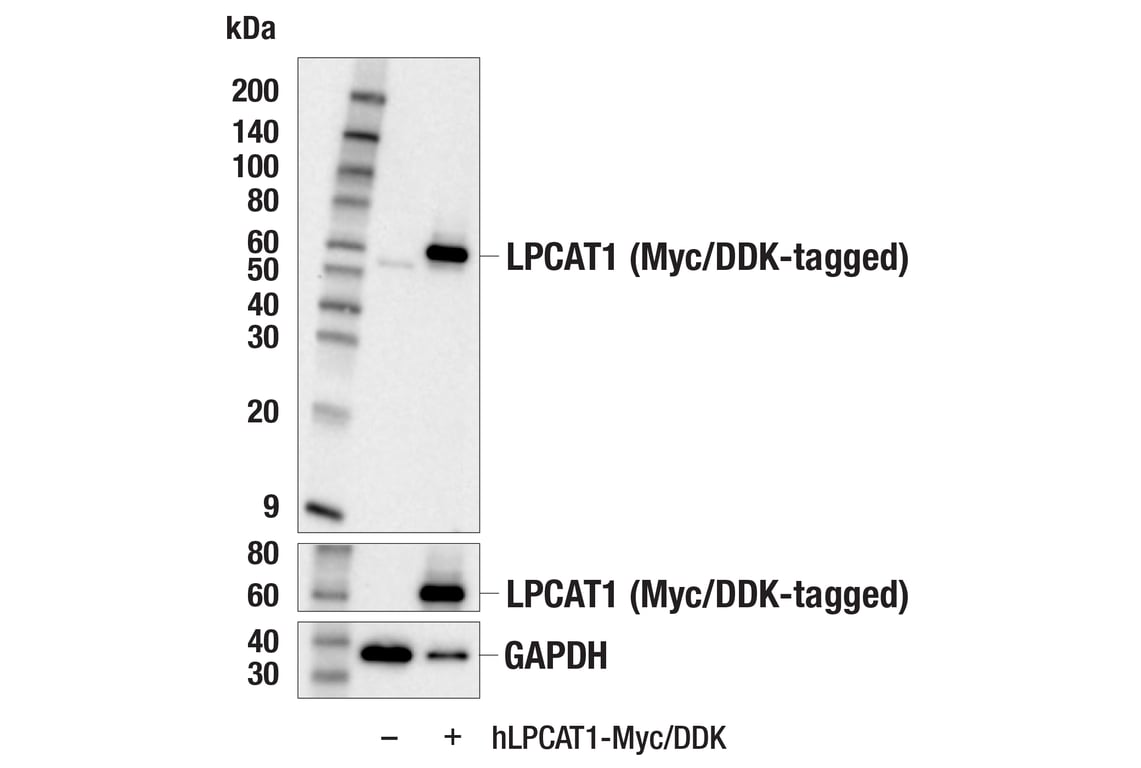 Western Blotting Image 2: LPCAT1 (E4V4B) Rabbit Monoclonal Antibody