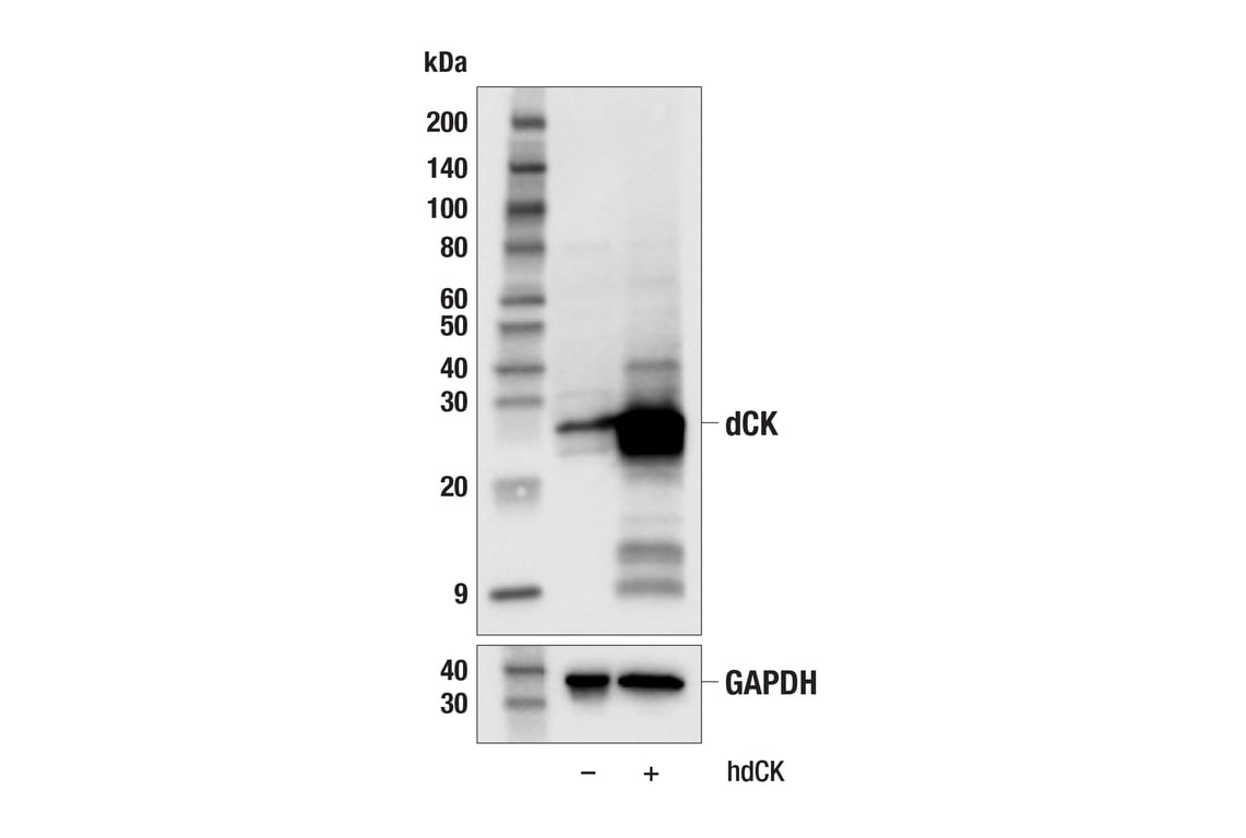 Western Blotting Image 2: dCK Antibody