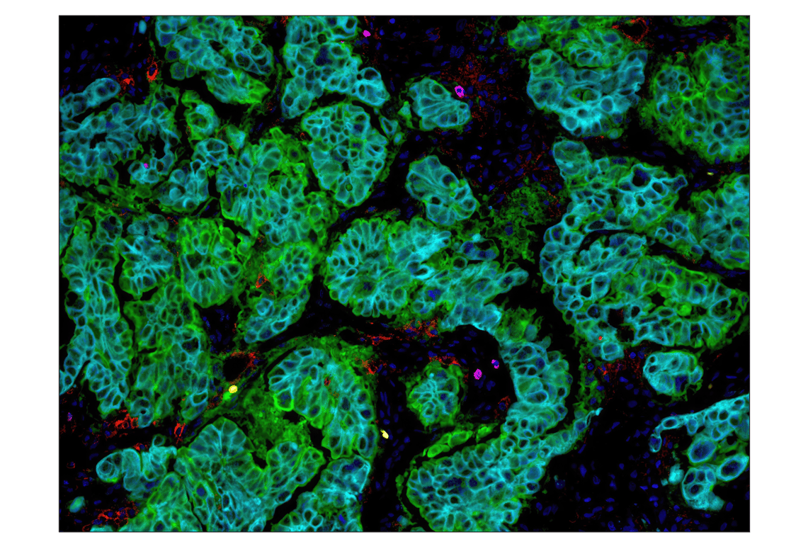 Immunohistochemistry Image 4: PD-L1 (E1L3N) Rabbit Monoclonal Antibody