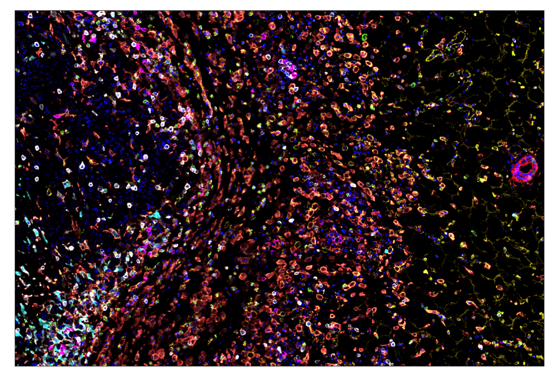 Immunohistochemistry Image 7: CD11b/ITGAM (E4K8C) & CO-0083-594 SignalStar<sup>™</sup> Oligo-Antibody Pair