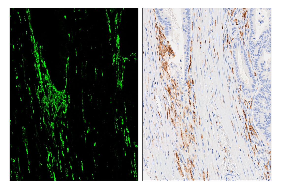 Immunohistochemistry Image 6: HLA-DRA (E9R2Q) & CO-0023-647 SignalStar<sup>™</sup> Oligo-Antibody Pair