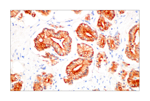 Immunohistochemistry Image 3: Pan-Keratin (AE1/AE3) Mouse Monoclonal Antibody