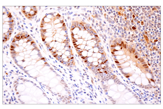 Immunohistochemistry Image 1: CDK2 (E8J9T) Rabbit Monoclonal Antibody