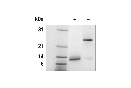 undefined Image 1: Human GDF5 Recombinant Protein