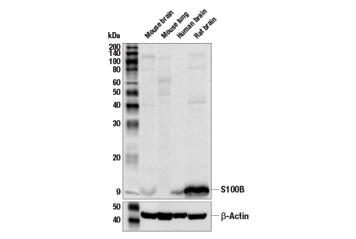 Western Blotting Image 2: S100B (E9F2I) Rabbit Monoclonal Antibody