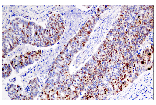 Immunohistochemistry Image 1: Cyclin D1 (E3P5S) Rabbit Monoclonal Antibody (BSA and Azide Free)