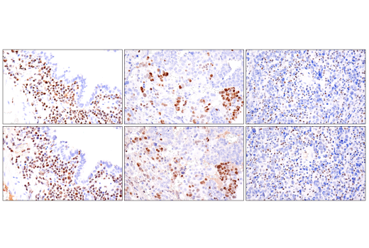 Immunohistochemistry Image 7: RUNX3/AML2 (E8D5W) Rabbit Monoclonal Antibody